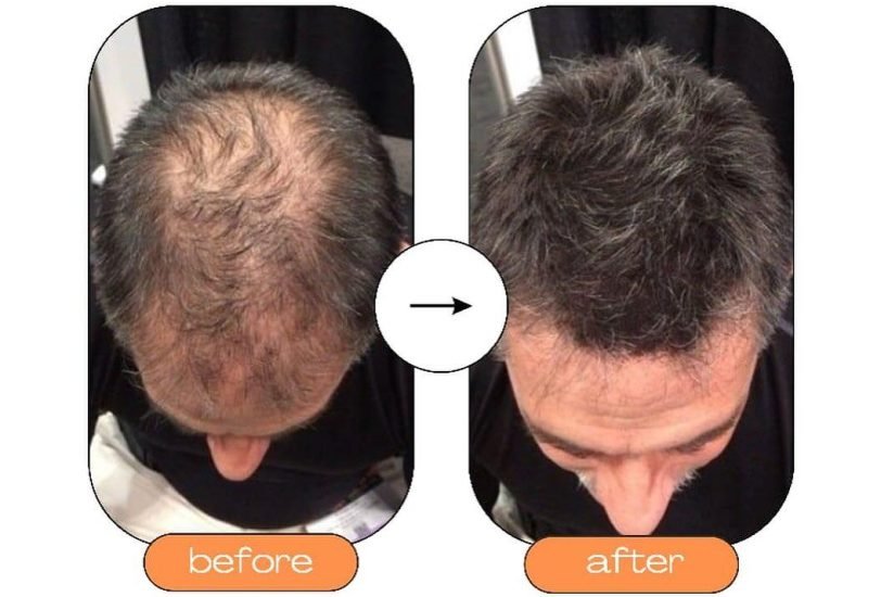 Hair Treatments