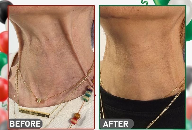 Anti-Aging Treatments