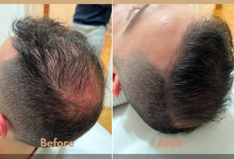 Hair Treatments