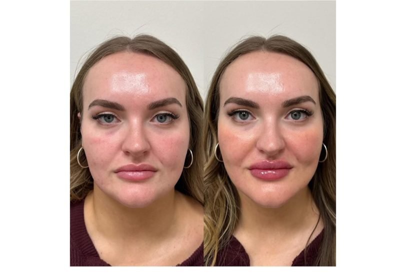 Anti-Aging Treatments