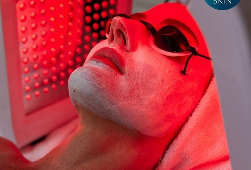 Laser & Light Therapies