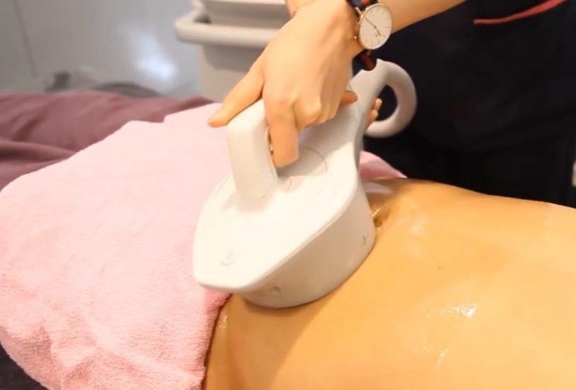 Body Contouring