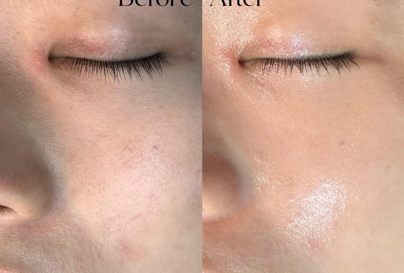Pore & Texture Refinement