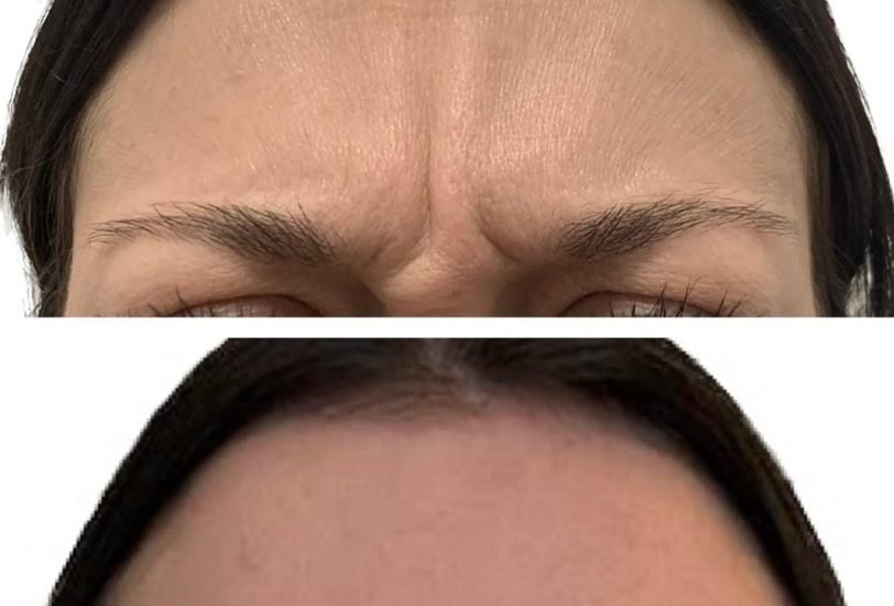 Anti-Aging Treatments