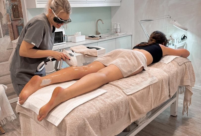 Laser Hair Removal