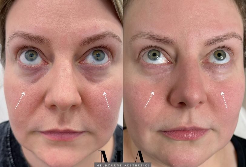 Anti-Aging Treatments