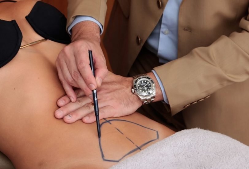 Body Contouring