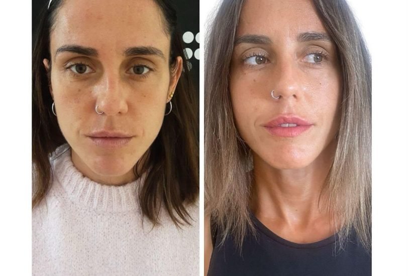Anti-Aging Treatments