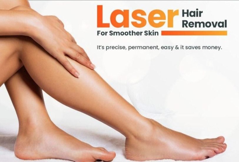 Laser Hair Removal