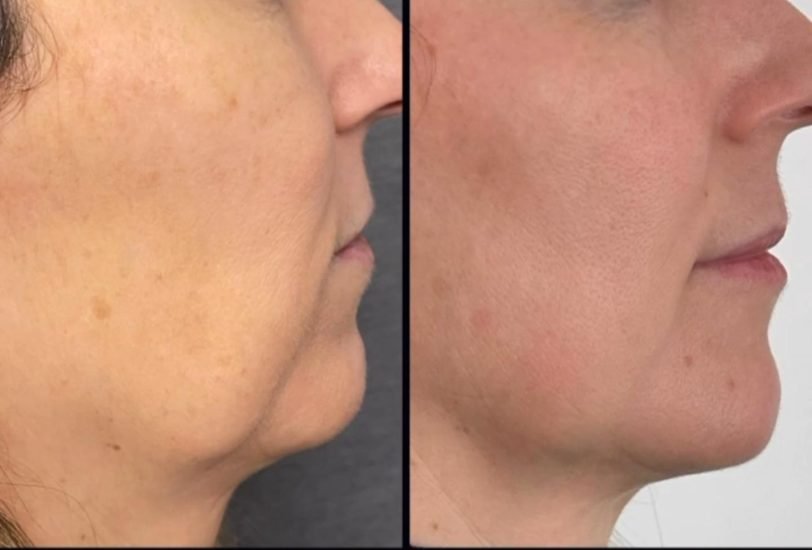 Anti-Aging Treatments