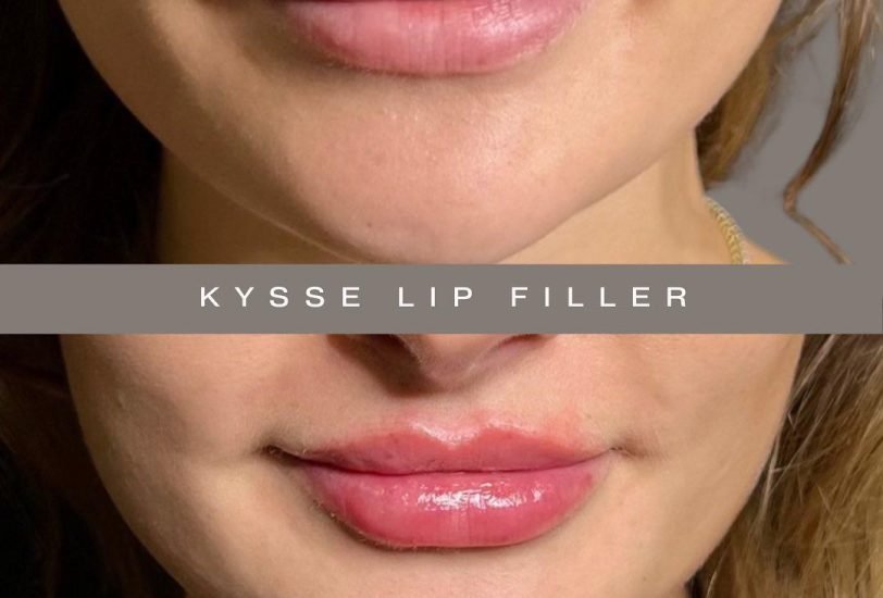 Lips Treatments