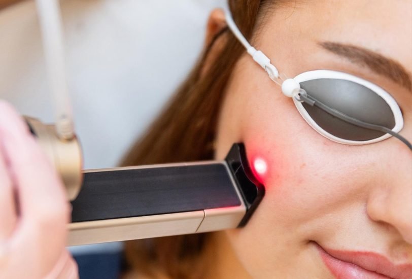 Vein Treatments