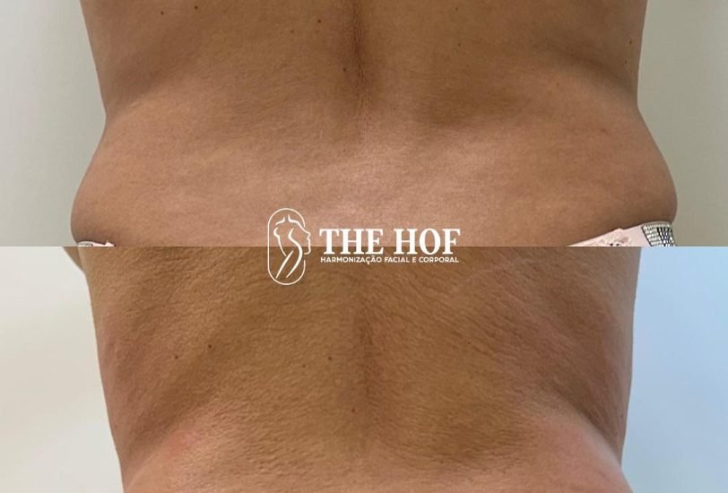 The Hof Clinic 4 – VerifiedCare Body Contouring