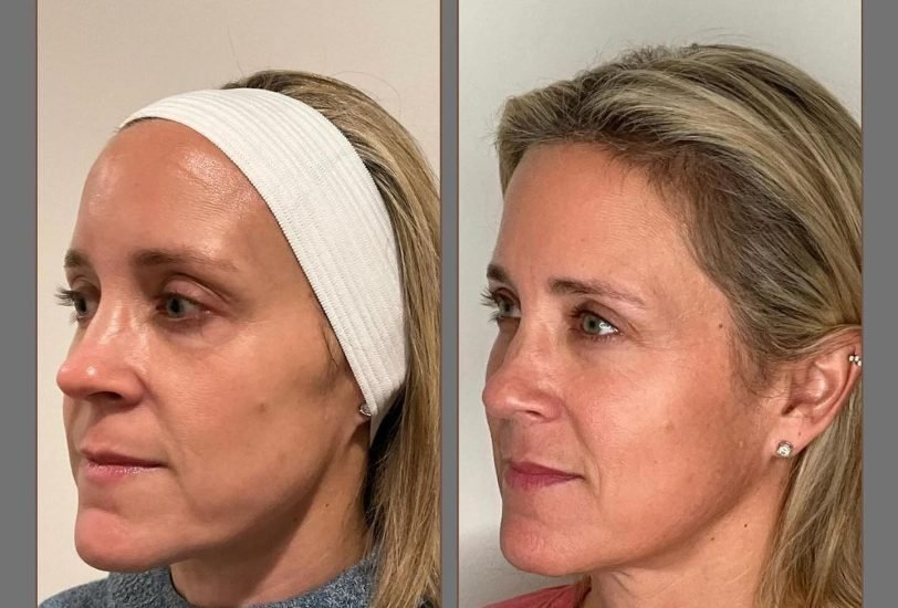 Anti-Aging Treatments