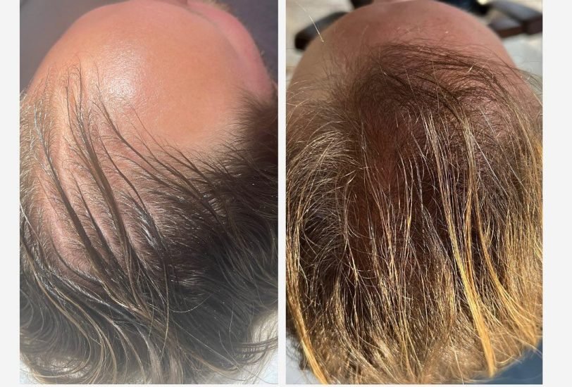Hair Treatments