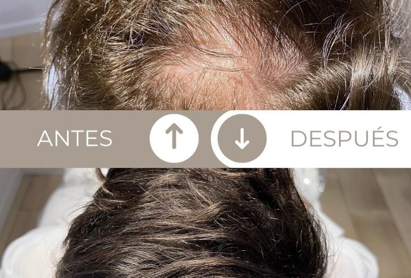 Hair Treatments