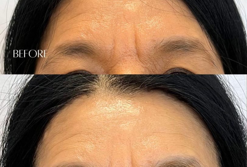 Anti-Aging Treatments