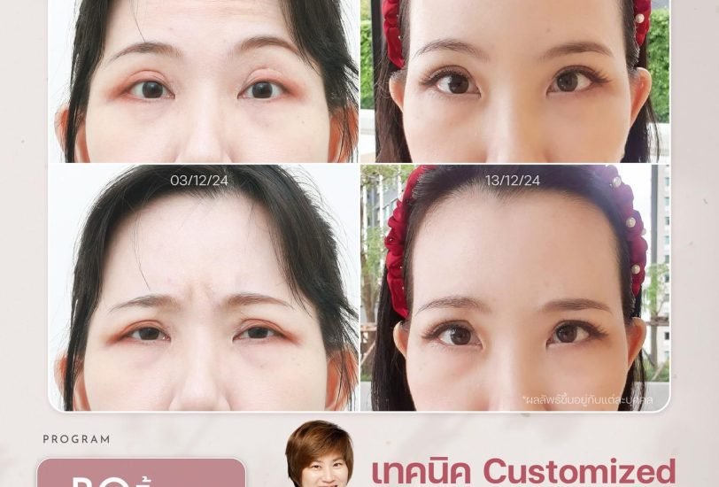Anti-Aging Treatments
