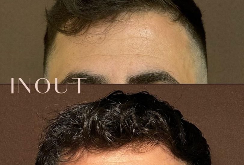 Hair Treatments