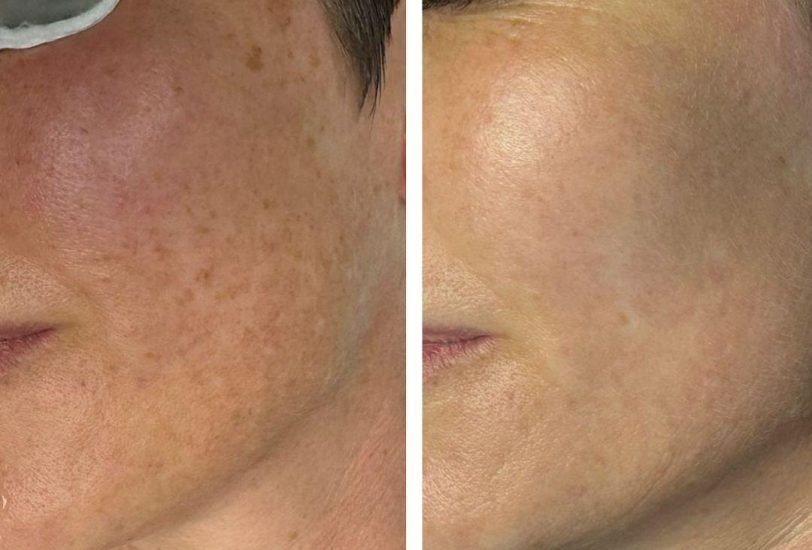 Anti-Aging Treatments