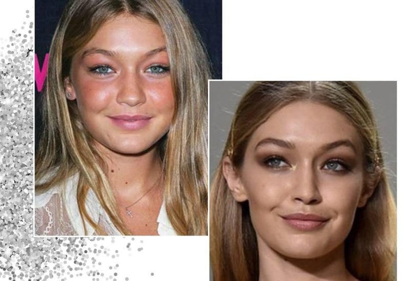 Injectable Treatments