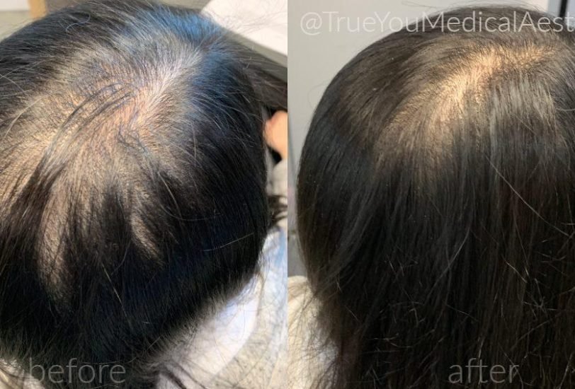 Hair Treatments