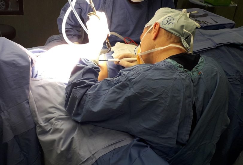 Liposuction