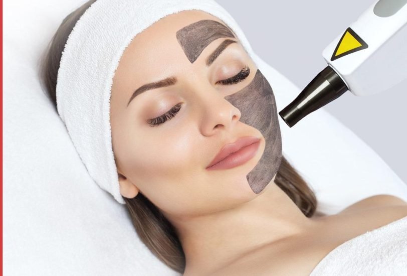 Laser Hair Removal