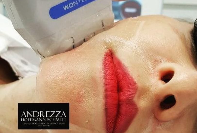 Double Chin & Jawline Contouring
