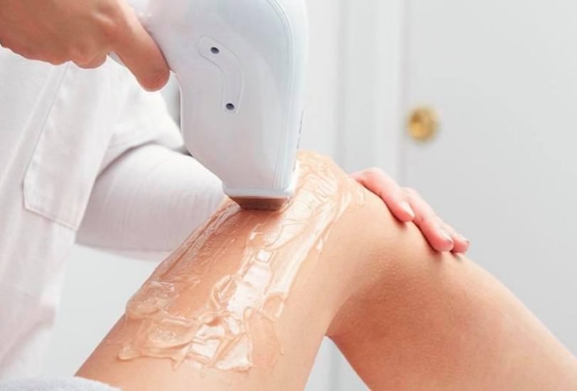Laser Hair Removal