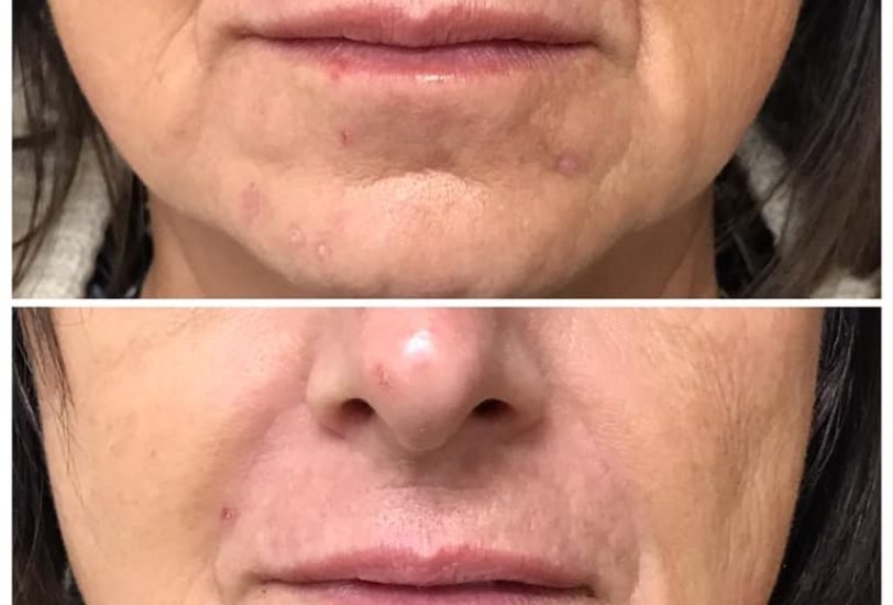 Anti-Aging Treatments