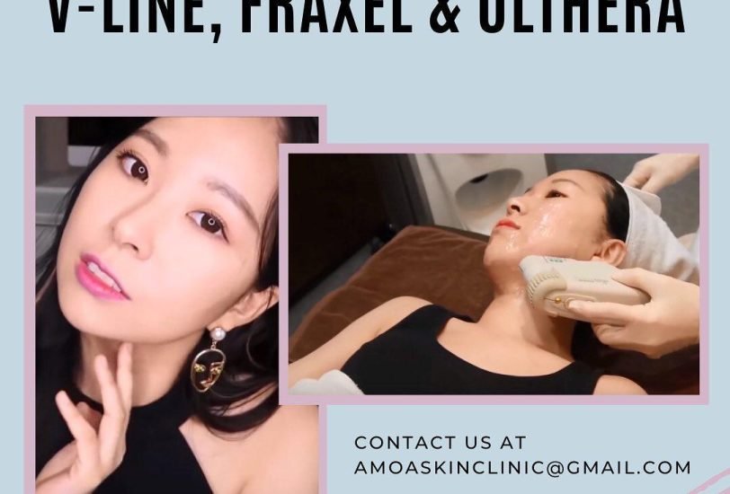 Double Chin & Jawline Contouring
