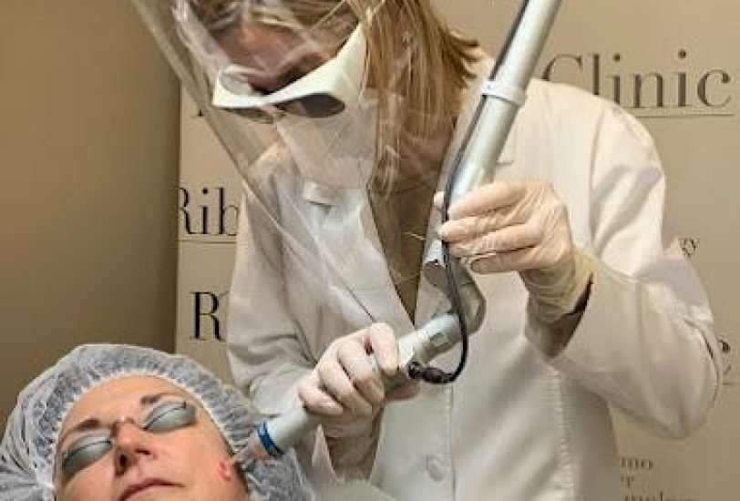 Laser Hair Removal
