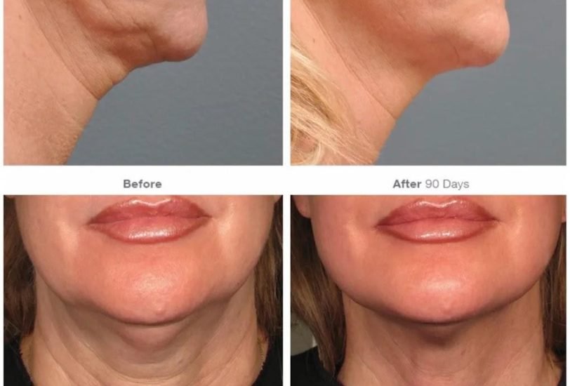 Anti-Aging Treatments