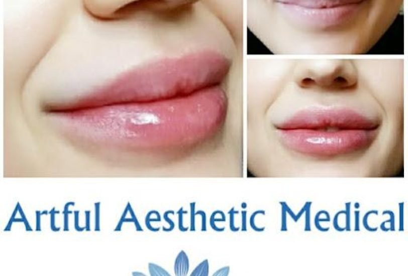 Lips Treatments