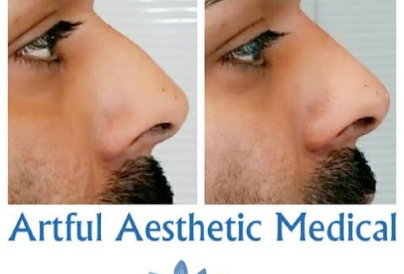 Pore & Texture Refinement
