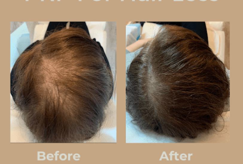 Hair Treatments