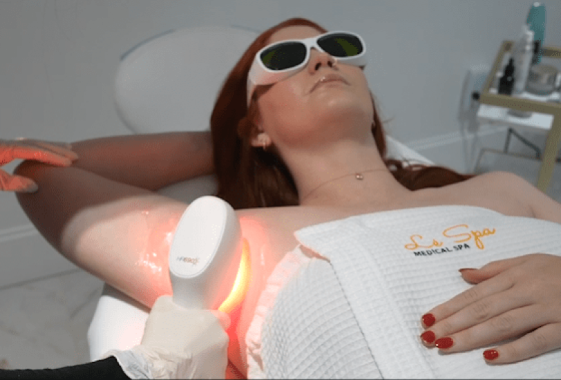Laser Hair Removal