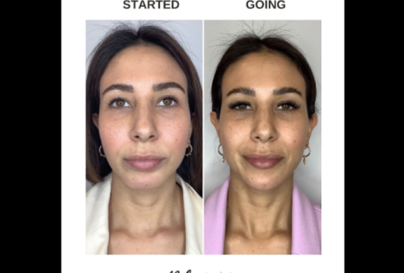 Attachment Image – VerifiedCare