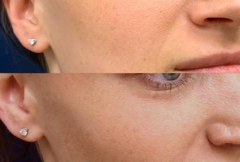 Anti-Aging Treatments