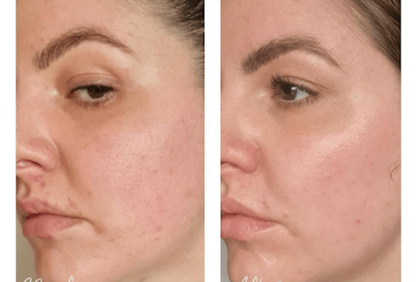 Anti-Aging Treatments