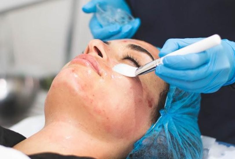 Skin Rejuvenation