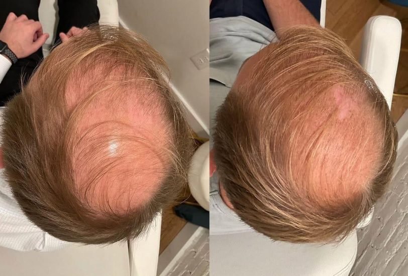 Hair Treatments