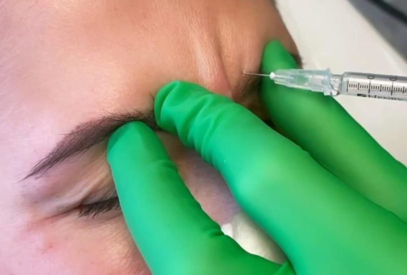 Injectable Treatments