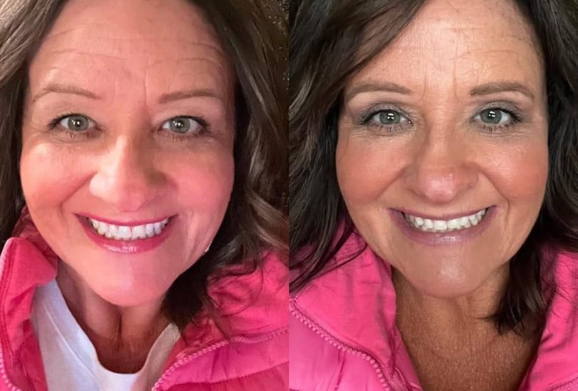 Anti-Aging Treatments