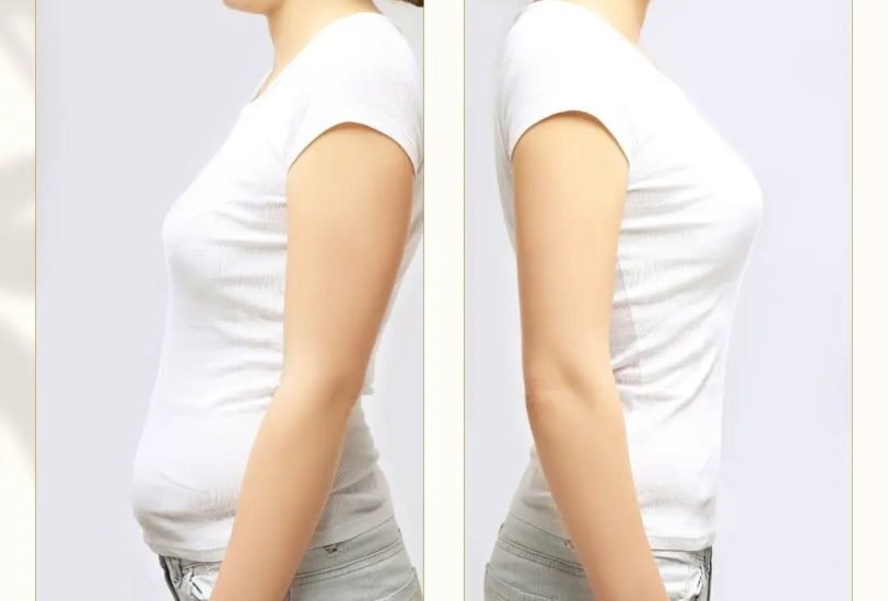 Body Contouring