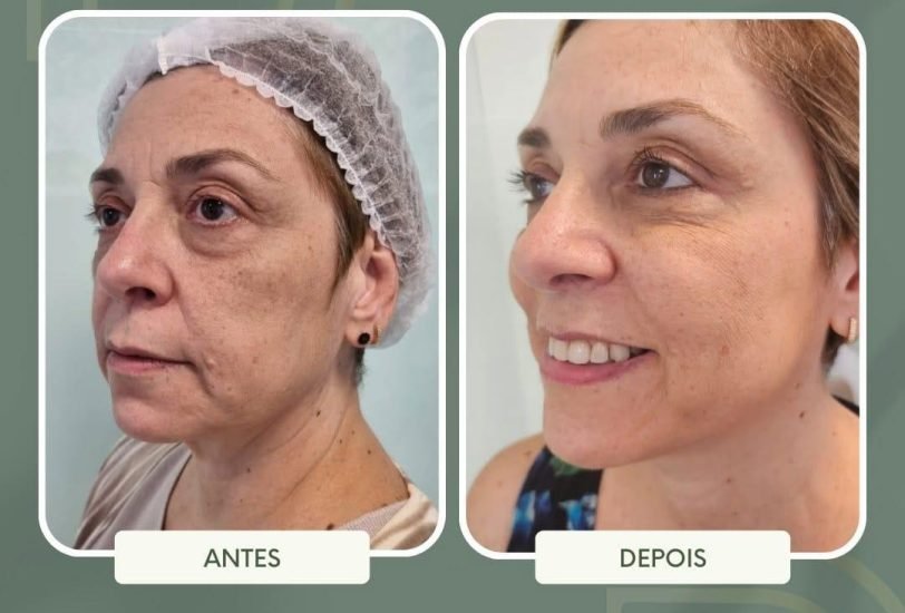 Anti-Aging Treatments
