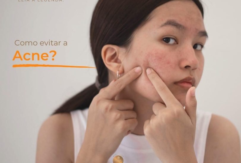 Acne & Scar Treatments