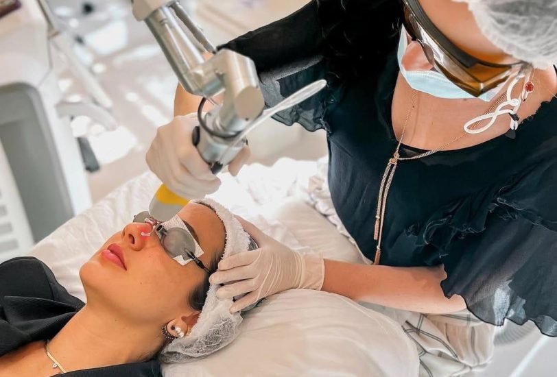 Laser Hair Removal