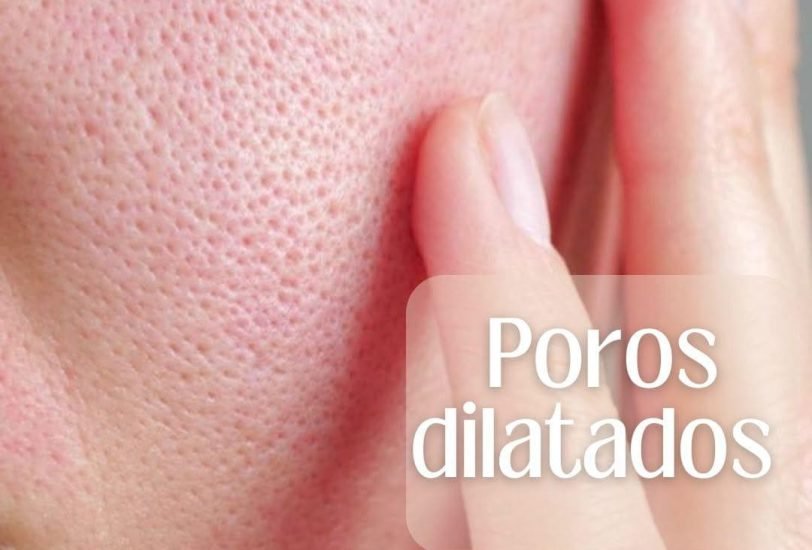 Pore & Texture Refinement